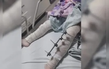 Médicos operam perna errada de criança e toda a equipe é afastada