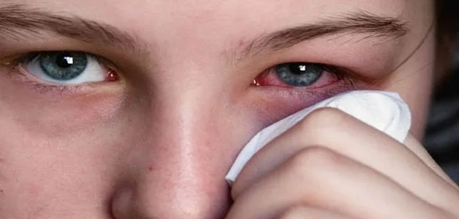 Descubra porque Oculax tem revolucionado o tratamento da medicina ocular