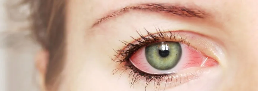 Descubra porque Oculax tem revolucionado o tratamento da medicina ocular