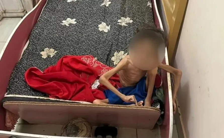  Irmão do bebê tem sete anos e foi encontrado com quadro de desnutrição grave 