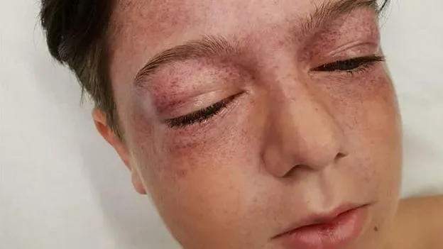 Menino de 11 anos fica gravemente ferido em novo desafio na internet; veja vídeo