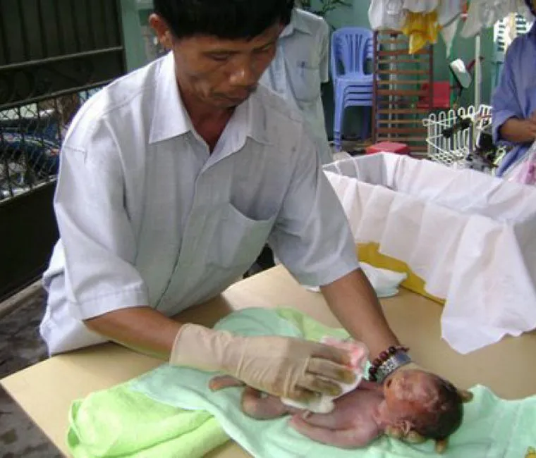 Para sensibilizar grávidas, vietnamita já recolheu e sepultou mais de 10 mil bebês abortados