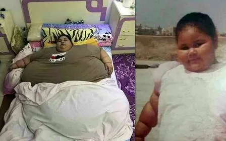 Mulher mais obesa do mundo, com 502 kg, vai ser submetida cirurgia bariátrica