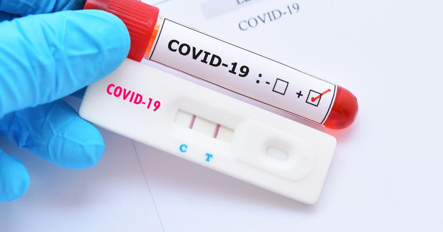 Mais dois casos positivos de coronavírus em Ivaiporã