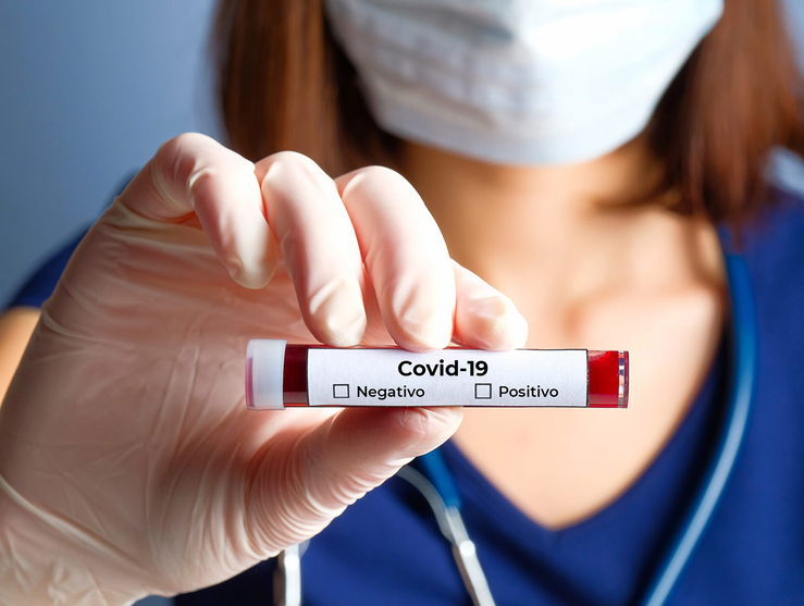 Arapongas confirma mais cinco mortes e 84 novos casos de Covid-19