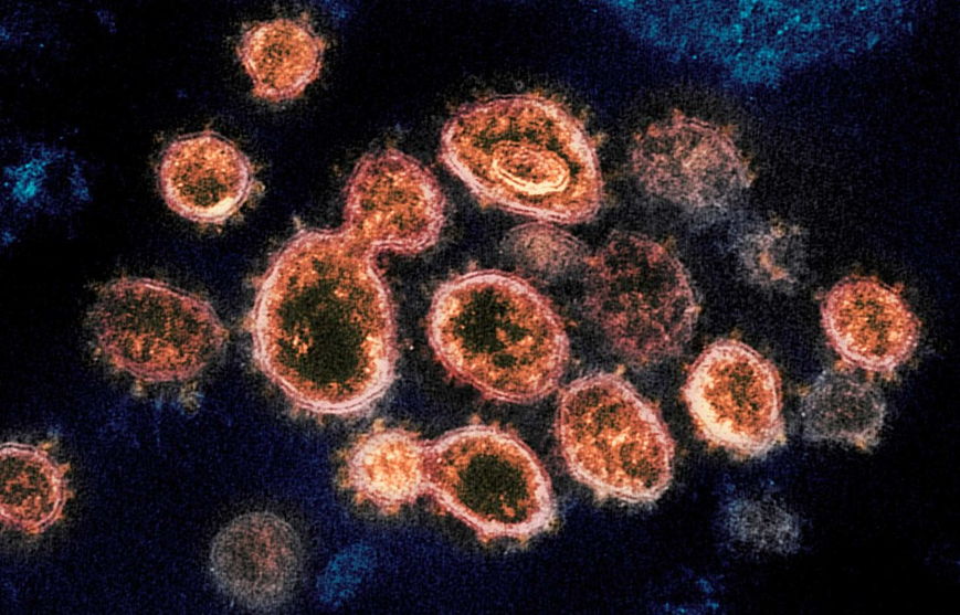 Londrina confirma mais 172 casos de coronavírus