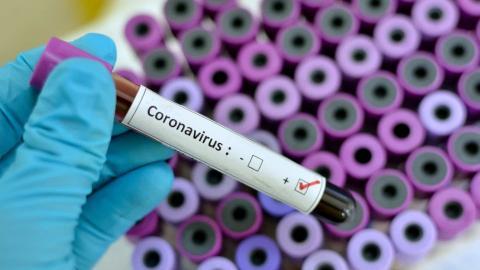 Apucarana registra 60 novos casos de coronavírus
