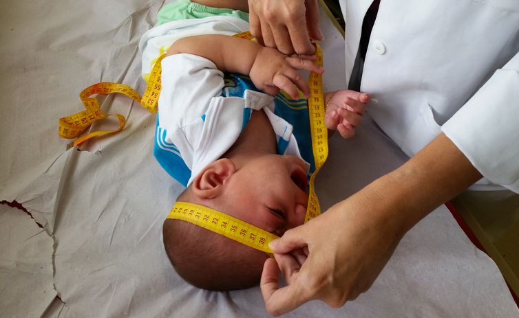 Mães de bebês com microcefalia vivem novos desafios