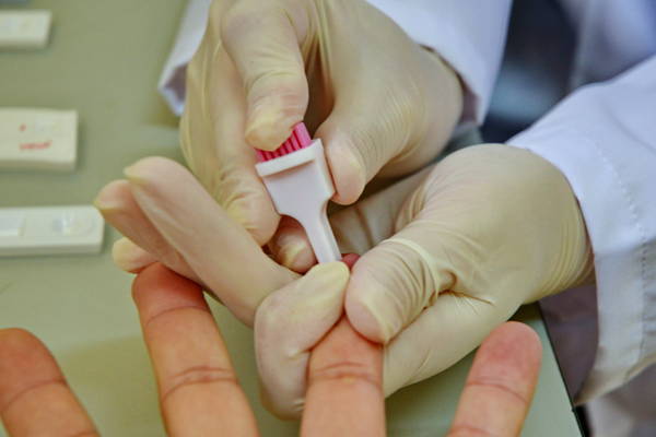 Testes rápidos regulares são uma das formas de garantir que pessoas que tem o HIV sem sintomas sejam tratadas