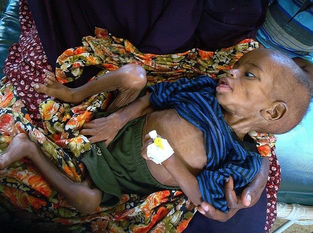 Fome na Somália leva Unicef a pedir ajuda internacional
