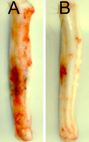 Medula espinhal de ratos 24 horas após ferimento cervical: a cobaia B recebeu tratamento para silenciar o gene Abcc8, com uma notável redução de hemorragia