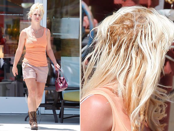 Britney e as falhas: problema chama-se alopecia de tração