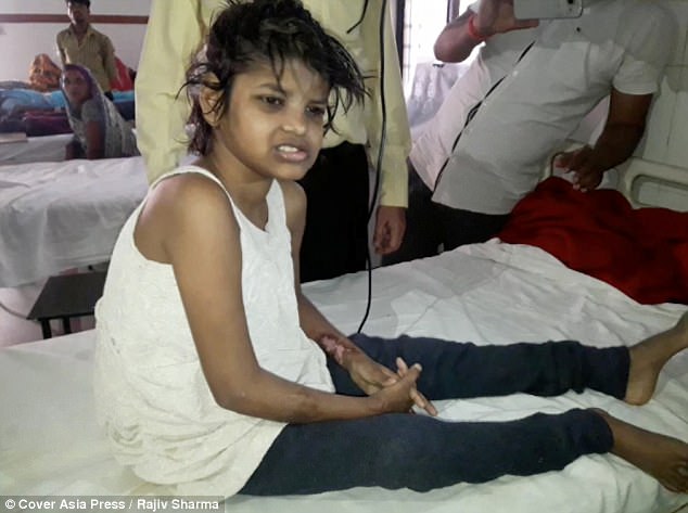 A garota de oito anos em cama de hospital depois de ser resgatada da selva - Foto: Rajiv Sharma/Asia Press