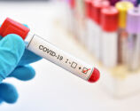 Jandaia do Sul registra 37 novos casos de Covid-19