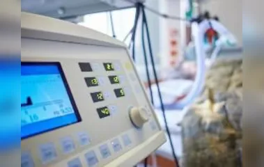 TCE fiscaliza compra de 335 respiradores para tratamento da Covid-19