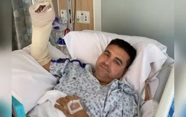 Buddy Valastro detalha acidente que causou cirurgia em sua mão
