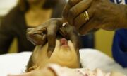 ONU diz que precisa de U$ 665 milhões para evitar novas epidemias