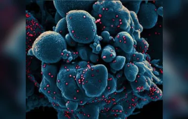 Segundo estudos, após 6 meses de infecção, anticorpos de pacientes apresentam mais resistência ao vírus