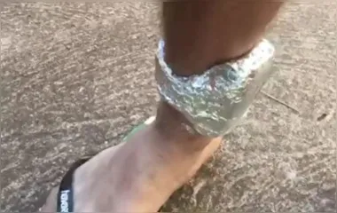 Suspeito cobre tornozeleira com alumínio para despistar localização