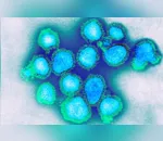 Regional de Saúde confirma óbito por H3N2 em Arapongas