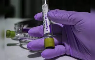 Governo deixa de exigir quarentena a não vacinados que desembarcarem no BR