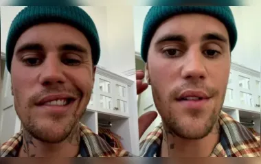 Entenda a doença que paralisou o rosto do astro pop Justin Bieber
