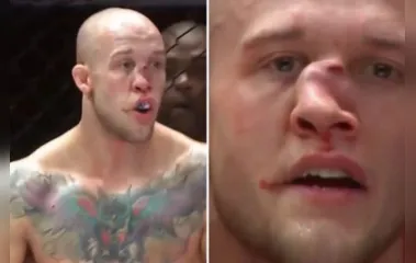 VÍDEO: lutador sofre fratura grave no nariz após levar joelhada
