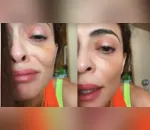 A atriz Juliana Paes (43), usou as redes sociais na noite da última sexta-feira, 02, para contar aos fãs o motivo de estar com o olho inchado