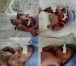 Os bebês se chamam Rafael, Samuel, Maria Vitória e Gabriel