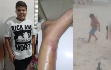 Menino de 12 anos morre em decorrência de fratura causada em futebol
