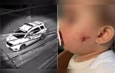 Policial é investigado por atirar no rosto de bebê com arma de airsoft