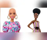 Barbie terá bonecas carecas e com vitiligo